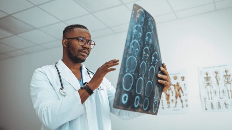 cerebrovascular disease