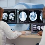 brain scan