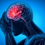stroke in ghana