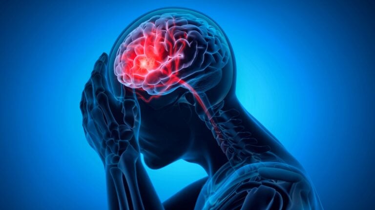 stroke in ghana