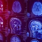 human brain scan