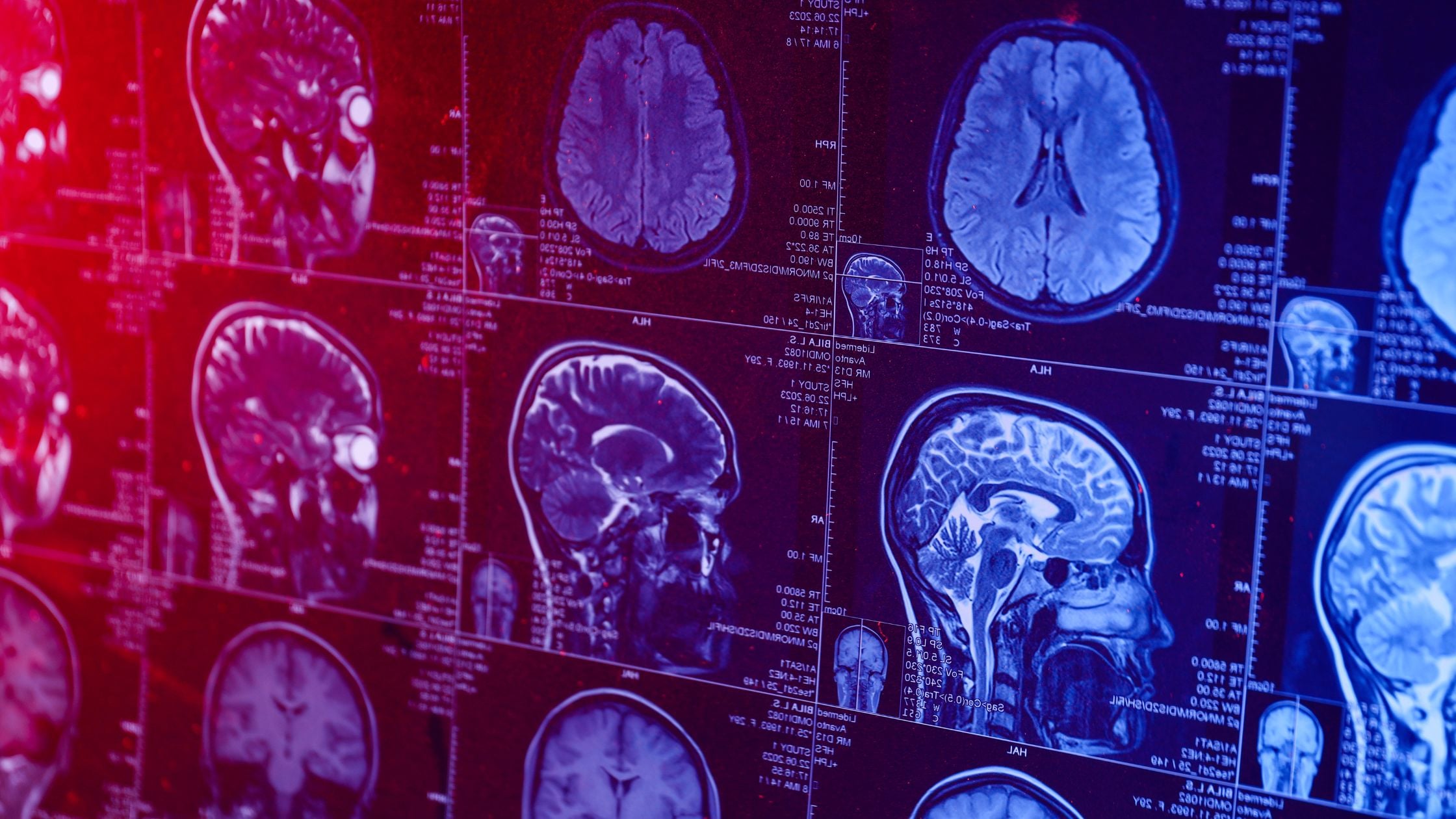 World Brain Day: Brain Health, Prevention & Awareness
