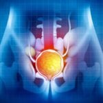benign prostatic hyperplasia (bph)