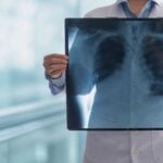 lung cancer awareness