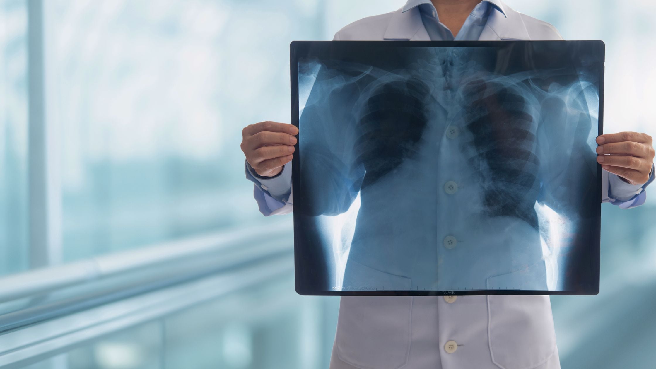 World Lung Cancer Day 2026: Raising Awareness of Lung Cancer, Early Detection, and Treatment Options